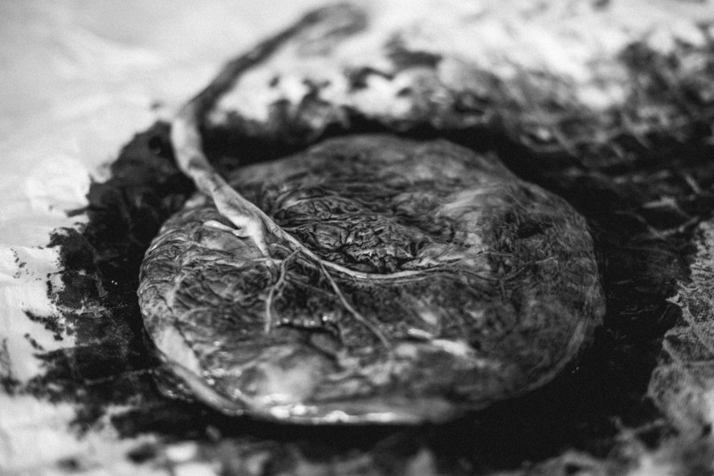 photographe accouchement toulouse albi